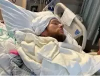 Jeff Garmany Injured in San Jose, CA Accident